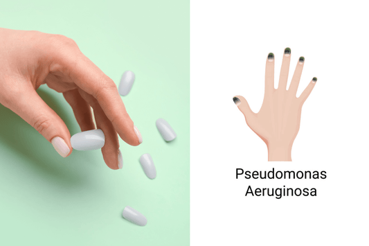 Green Nail After Press-Ons: Causes, Treatments, and Prevention