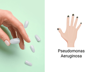 Green Nail After Press-Ons: Causes, Treatments, and Prevention